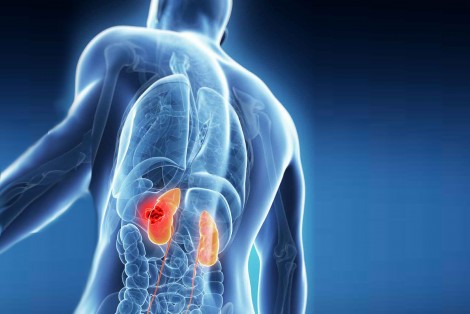 Urinary Diseases